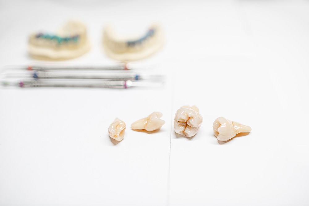 假牙材質的選擇與影響：專業醫師淺談假牙的多種選項