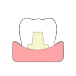 全皓冠牙齒示意圖