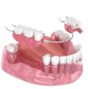 局部活動假牙