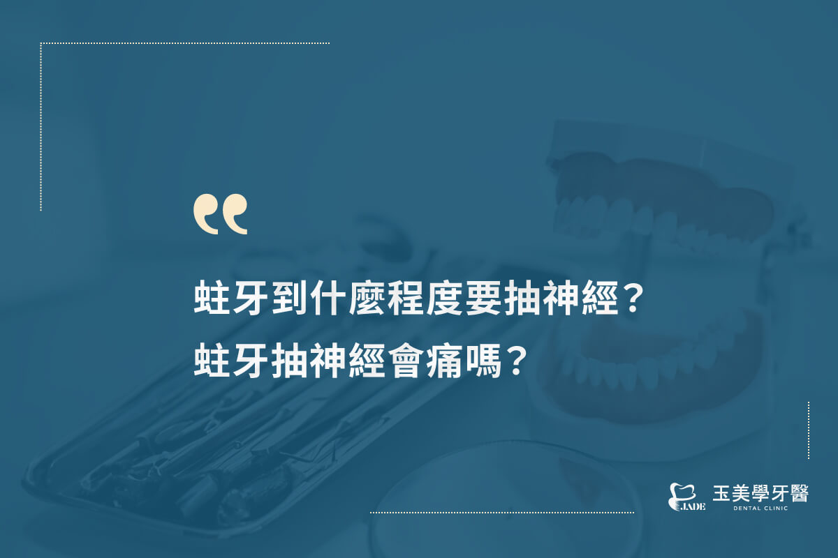 蛀牙到什麼程度要抽神經？蛀牙抽神經會痛嗎？