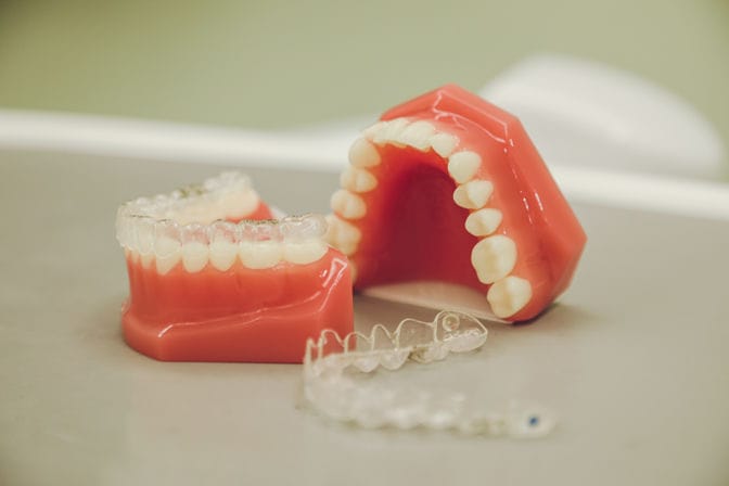 隱適美清潔的完美攻略:保持隱適美矯治器整潔的秘訣