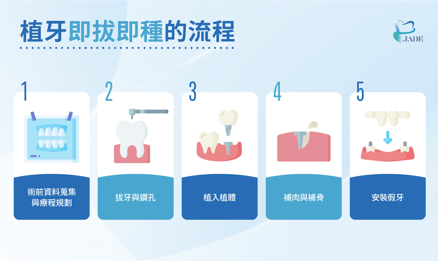 玉美學牙醫「植牙即拔即種」五大步驟圖解，快速縮短植牙療程時程