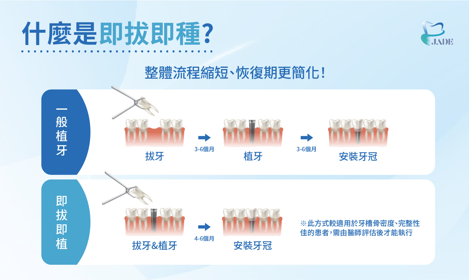 什麼是即拔即種？即拔即植比一般植牙整體流程縮短、恢復期更簡化！