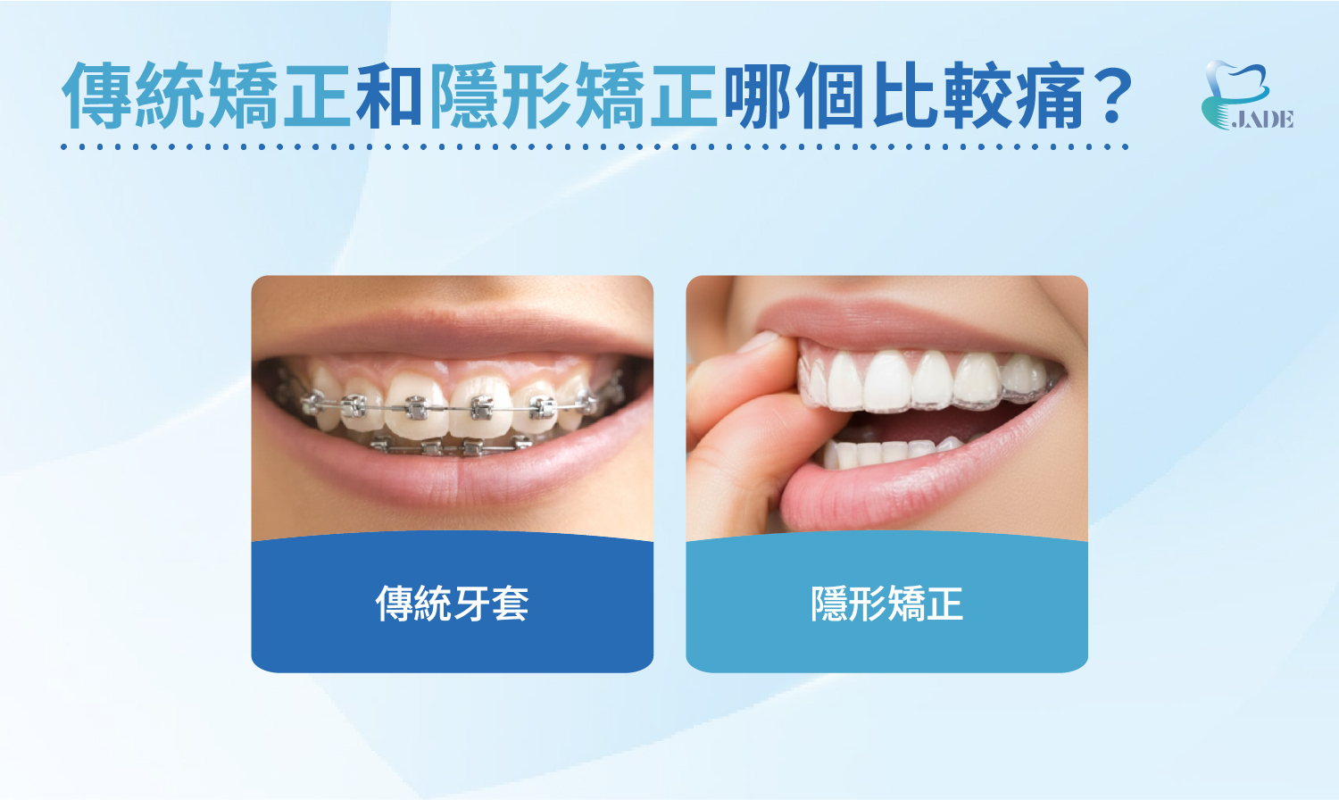 傳統矯正和隱形矯正哪個比較痛？