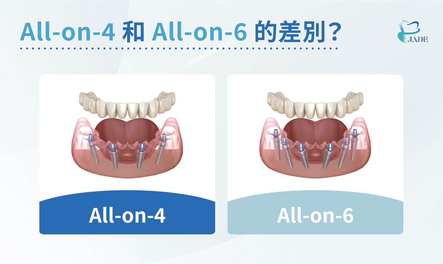 All-on-4 和 All-on-6 的差別?