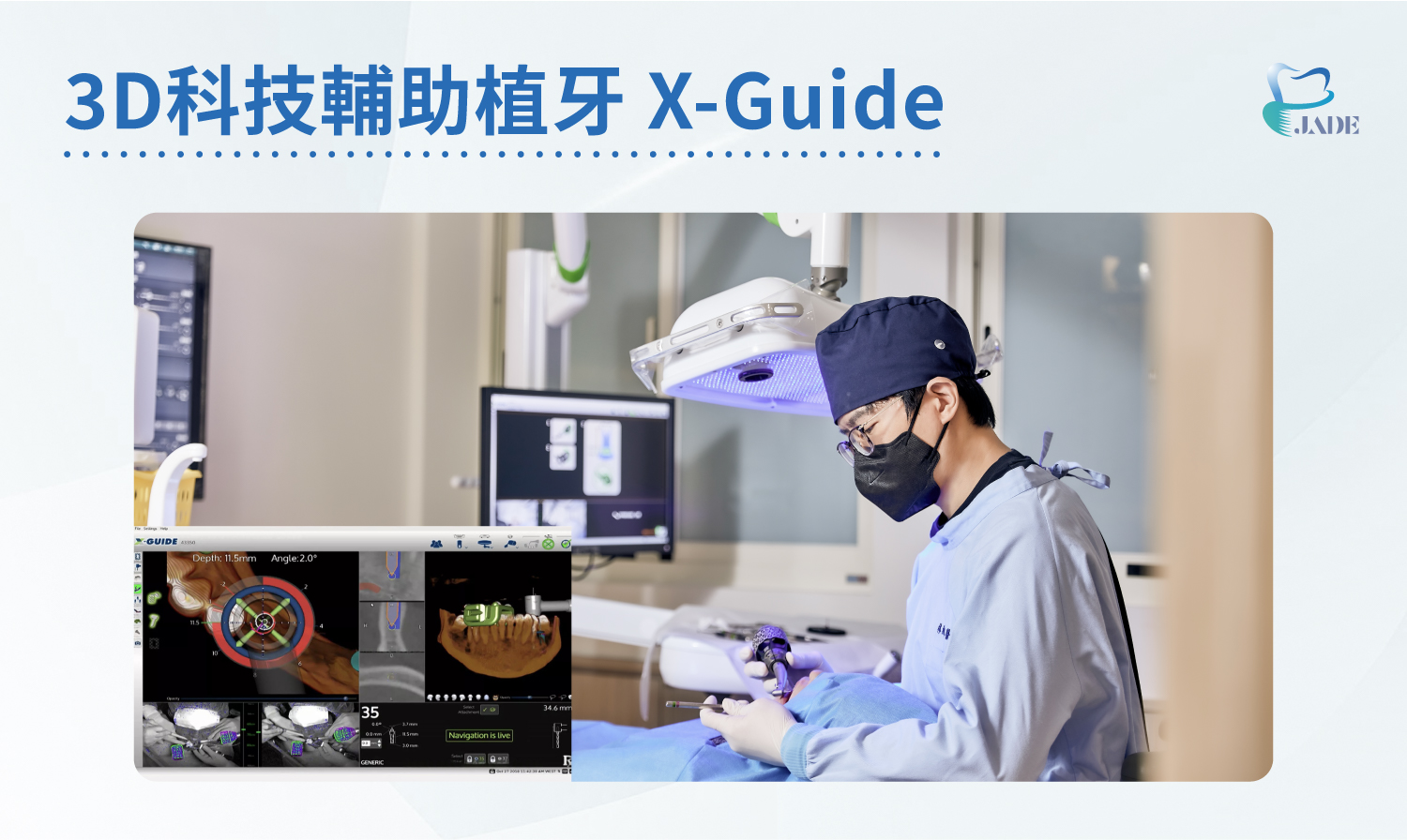 3D 科技輔助植牙 X-Guide|林致廷醫師操作機器