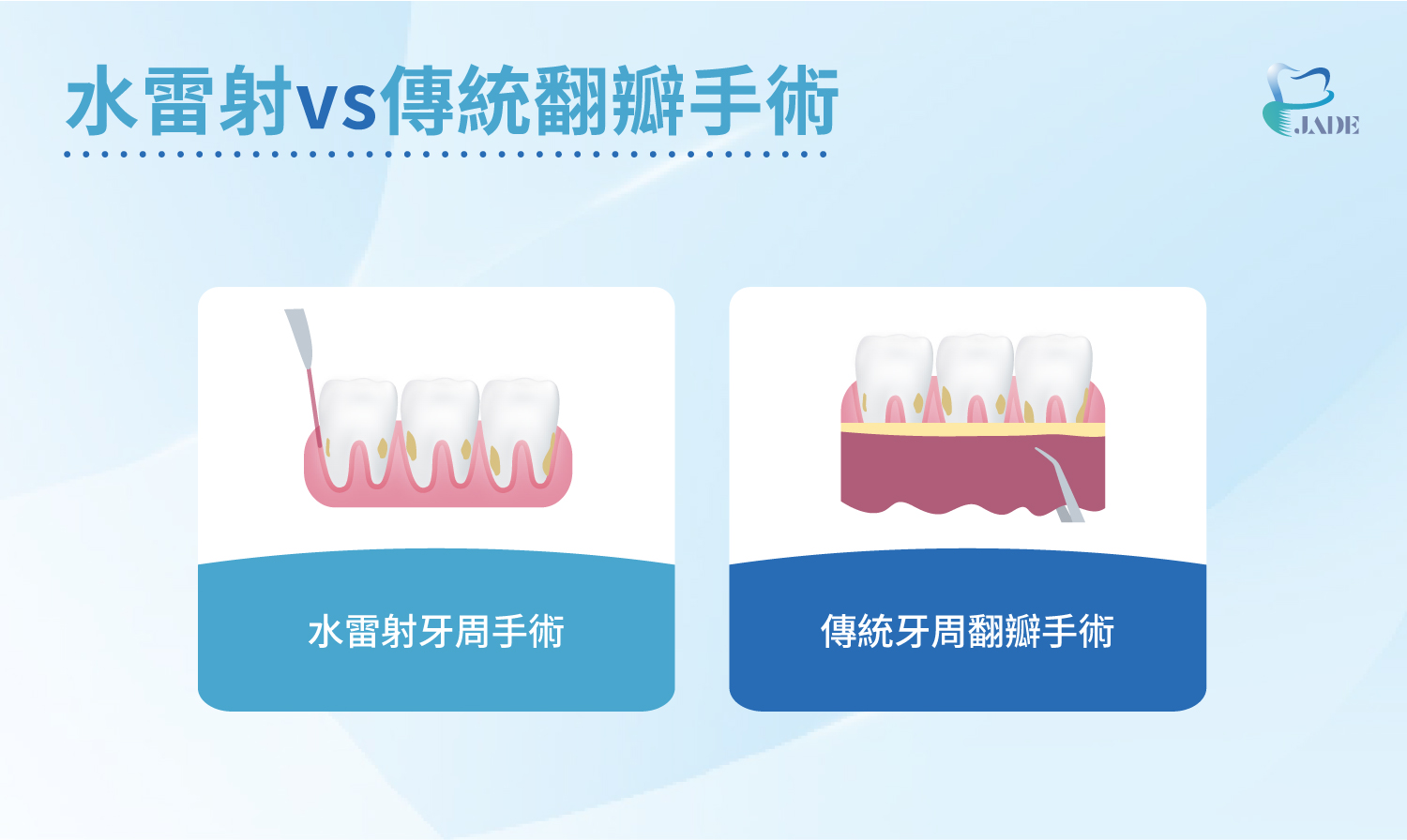 水雷射 vs 傳統翻瓣手術|玉美學牙醫診所