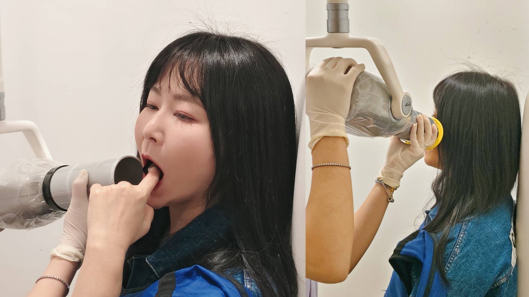 小美使用X光機照口腔內牙齒狀況