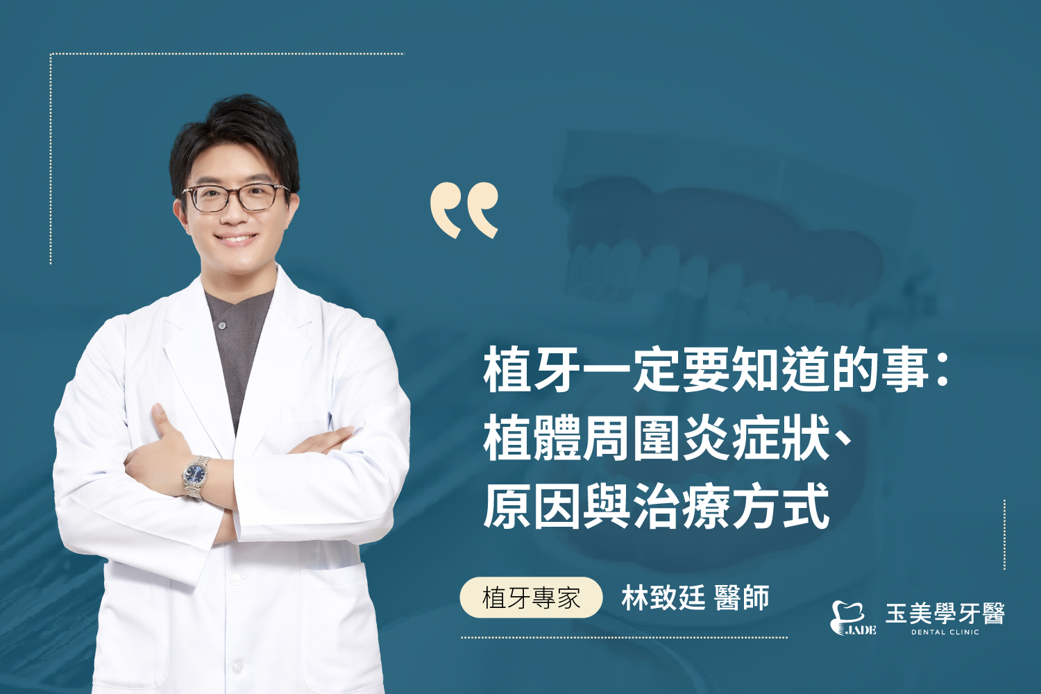 植牙後一定要知道的事：植體周圍炎症狀、原因與治療方式